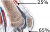 घुटने के जोड़ और पटेलर लिगामेंट के टेंडोनाइटिस के लक्षण, चरण और उपचार, पटेलर लिगामेंट के टेंडोनाइटिस उपचार
